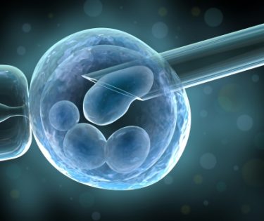 fertilizare-in-vitro