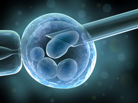 fertilizare-in-vitro
